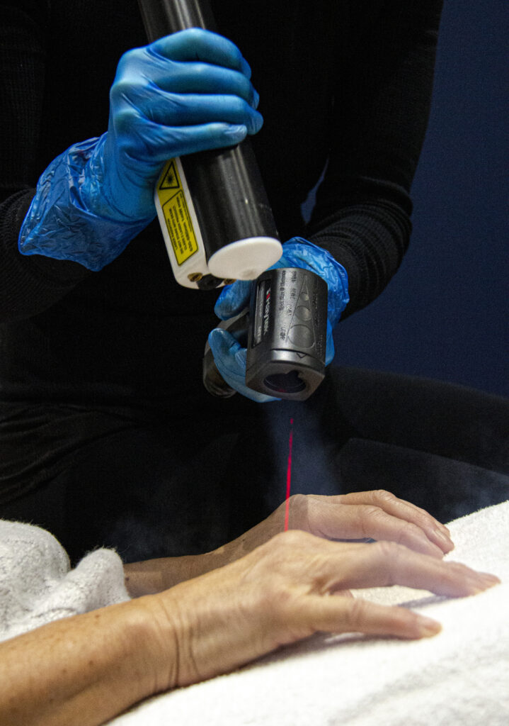 Local Cryotherapy: Toronto's Top Rated Clinic